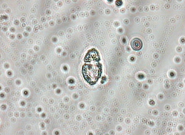Dictyocha speculum